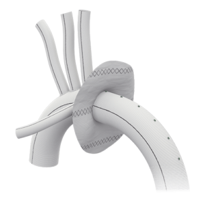 TERUMO VASCUTEK GELWEAVE VASCULAR GRAFT, STRAIGHT 12MM X 30CM (733012)