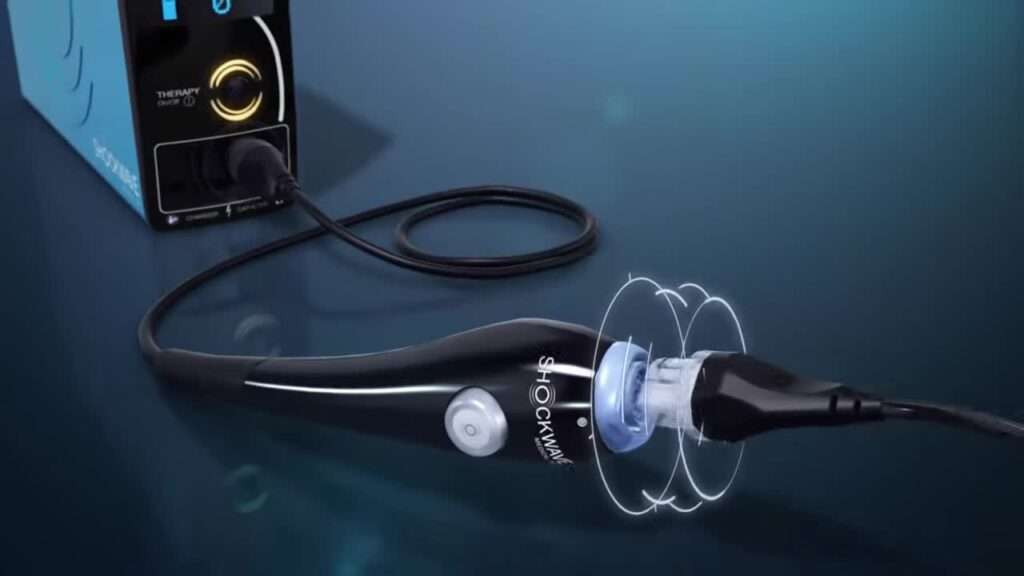 Shockwave Connector Cable (IVLCC)