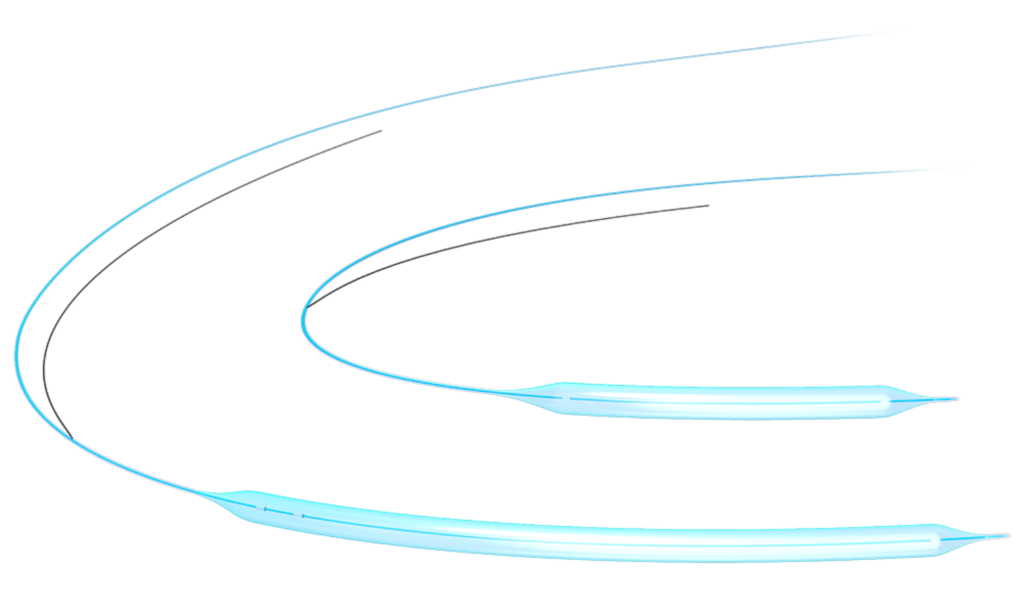 Cordis Saber PTA Dilatation Catheter 0.18" 90cm 6F